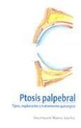 ptosis palpebral tipos exploracion y tratamiento quirurgico