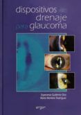 Dispositivos de drenaje para glaucoma