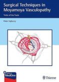 surgical techniques in moyamoya vasculopathy tricks of the trade