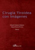 cirugia tiroidea con imagenes