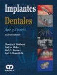 implantes dentales: arte y ciencia (2ª ed.)