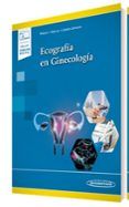 ecografia en ginecologia