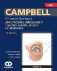 campbell ortopedia quirurgica tomo 2 amputaciones infecciones y tum