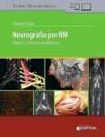 neurografia por rm plexos y nervios perifericos libro  e-book