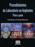 procedimientos de laboratorio en implantes paso a paso