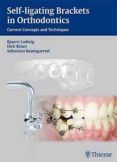 self-ligating brackets in orthodontics current concepts and tech niqu
