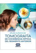 atlas clinico de tomografia de coherencia optica del segmento anterior