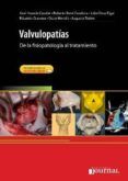 valvulopatias de la fisiopatologia al tratamiento  acceso onlin e