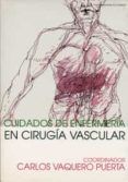cuidados de enfermeria en cirugia vascular