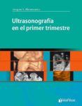 ultrasonografia en el primer trimestre