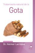tratamiento natural de la gota