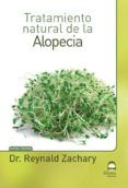 tratamiento natural de la alopecia