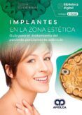 implantes en la zona estética. guía para el tratamiento del paciente p