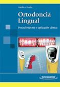 ortodoncia lingual