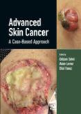 Advanced Skin Cancer