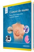 cancer de mama
