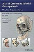 atlas of craniomaxillofacial osteosynthesis microplates minipla tes a
