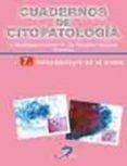 citopatologia de la mama
