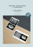 Hernias Infrecuentes y Complejas