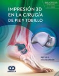 impresion 3d en la cirugia de pie y tobillo