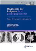 diagnostico por imagenes de la patologia pulmonar