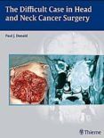 the difficult case in head and neck cancer surgery