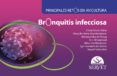 bronquitis infecciosa principales retos en avicultura