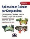 aplicaciones guiadas por computadora. para implantes dentales injertos