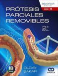 prótesis parciales removibles