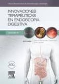 innovaciones terapeuticas en endoscopia digestiva