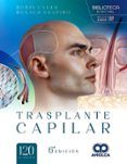 trasplante capilar