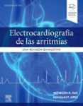 electrocardiografia de las arritmias