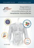 diagnostico y monitorizacion inmunofenotipica de las neoplasias leucocitarias