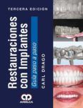 restauraciones con implantes (3ª ed.) 2017