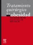 tratamiento quirurgico de la obesidad