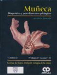 muneca diagnostico y procedimientos quirurgicos 2 vols