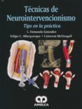 tecnicas de neurointervencionismo: tips en la practica