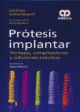 protesis implantar: ventajas complicaciones y soluciones practicas