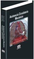 asistencia circulatoria mecanica: principios y aplicaciones