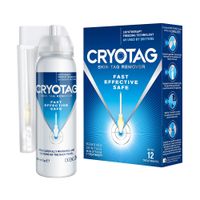 cryotag skin tag remover
