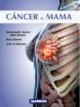 cancer de mama: premium