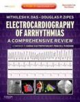 electrocardiograhy of arrhythmias a comprehensive review a comp anion