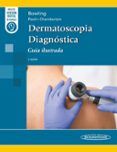 Dermatoscopia Diagnóstica