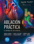 ablación práctica. el enfoque de los expertos