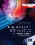 tratamiento exhaustivo de la artrosis de rodilla avances recientes