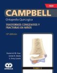 campbell ortopedia quirurgica tomo 3 trastornos congenitos y fractu