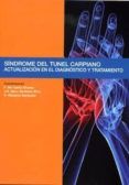 sindrome del tunel carpiano
