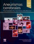aneurismas cerebrales