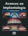 avances en implantologia