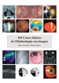 101 casos clínicos de oftalmología con imagen